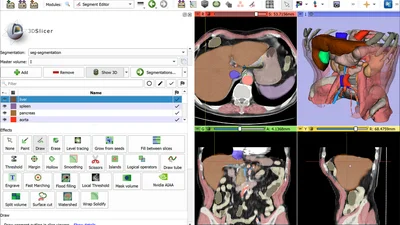3D Slicer render of Sample 1