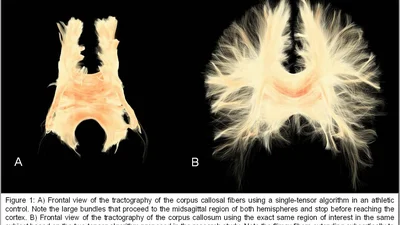 3D Slicer render of Sample 3